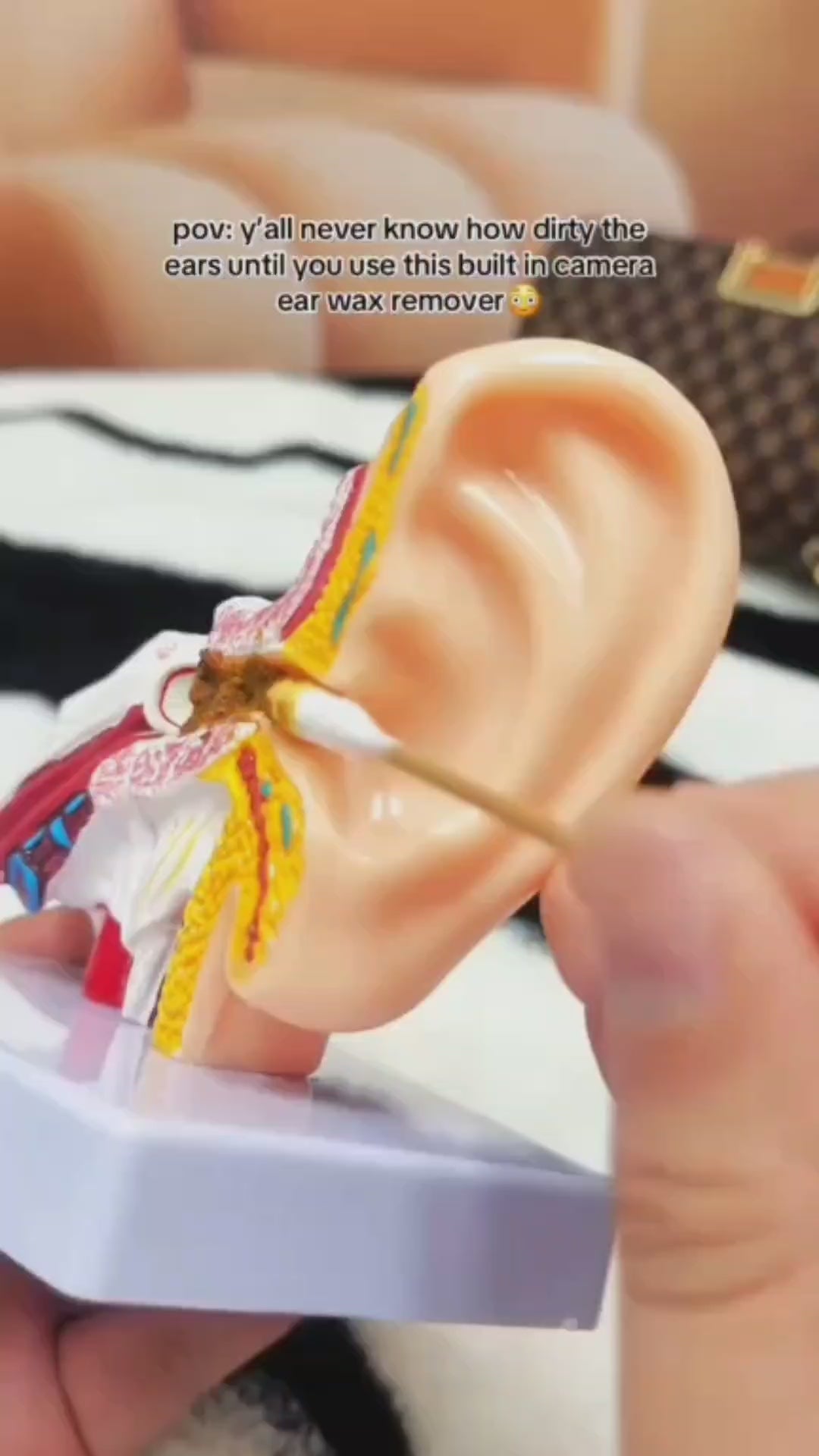 Smart Visual Ear Wax Cleaner